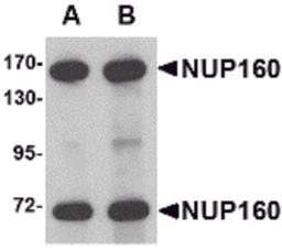 Western blot analysis of NUP160 in rat brain tissue lysate with NUP160 antibody at (A) 0.5 and (B) 1 μg/mL.