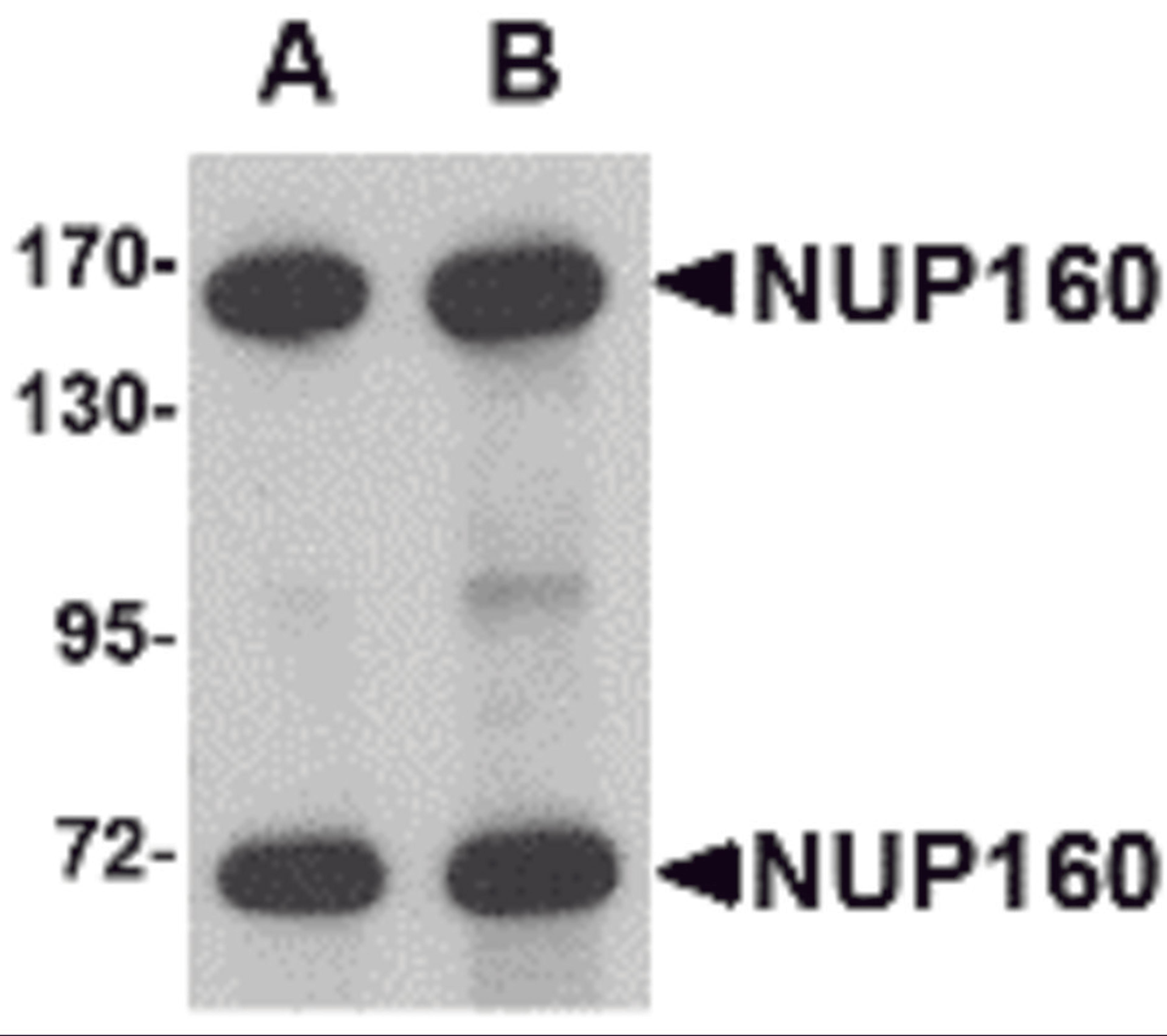 Western blot analysis of NUP160 in rat brain tissue lysate with NUP160 antibody at (A) 0.5 and (B) 1 μg/mL.