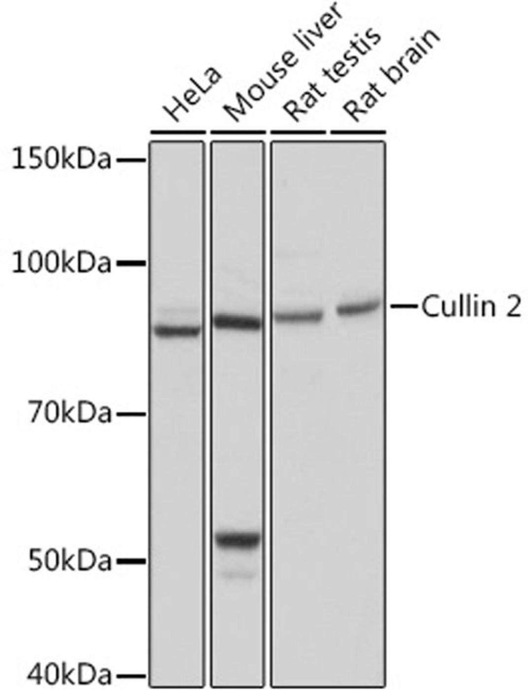 Western blot - Cullin 2 Rabbit mAb (A5076)