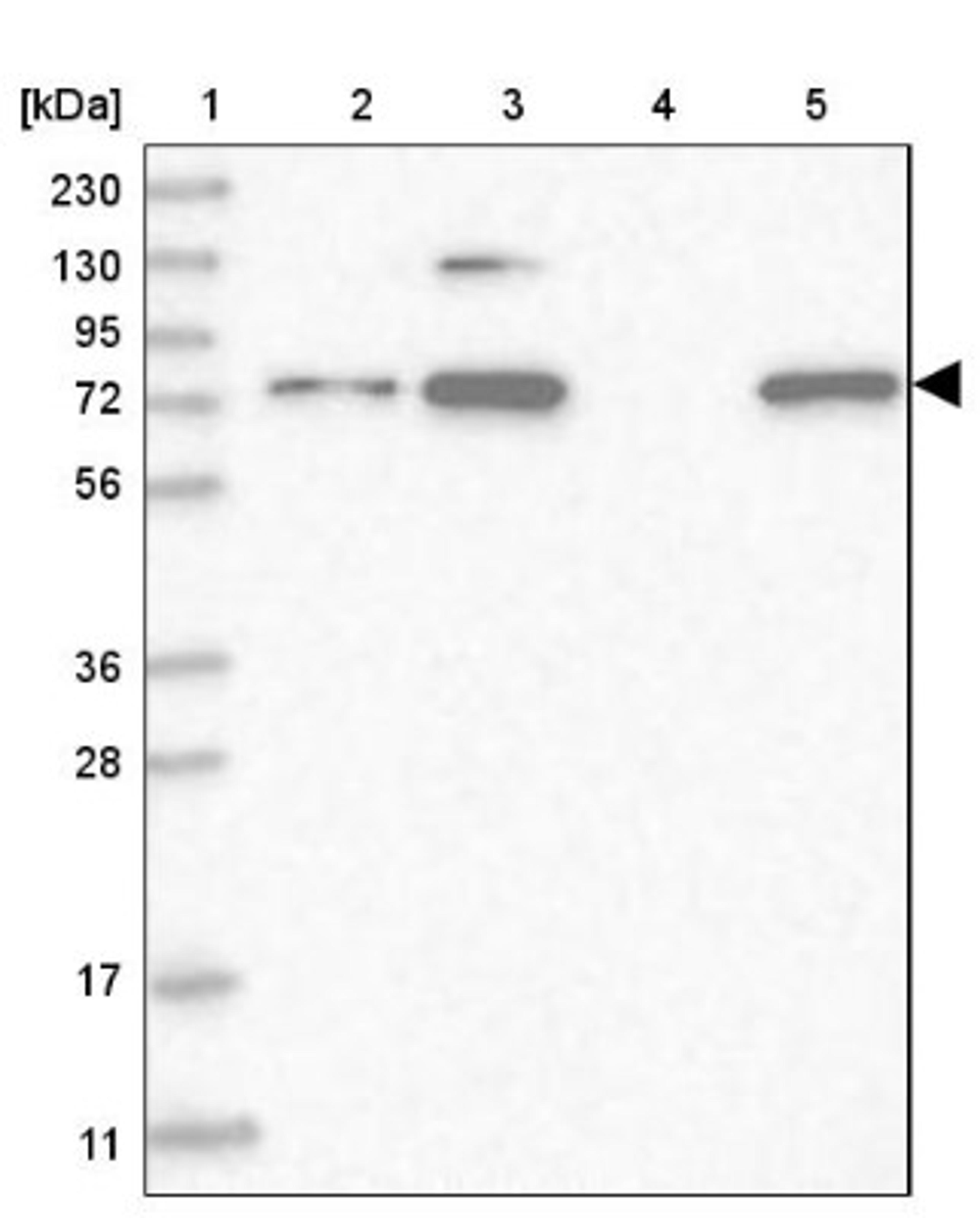 Western Blot: C3orf25 Antibody [NBP1-85882] - Lane 1: Marker [kDa] 230, 130, 95, 72, 56, 36, 28, 17, 11<br/>Lane 2: Human cell line RT-4<br/>Lane 3: Human cell line U-251MG sp<br/>Lane 4: Human plasma (IgG/HSA depleted)<br/>Lane 5: Human liver tissue