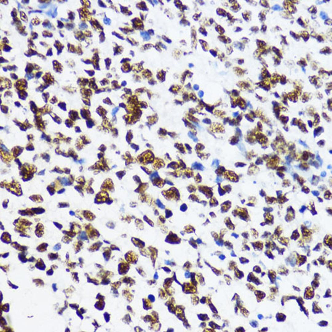 Immunohistochemistry  - Acetyl-Histone H4-K12 antibody (A14227)