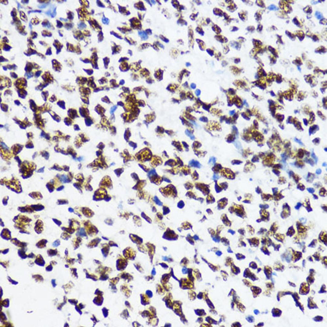 Immunohistochemistry - Acetyl-Histone H4-K12 antibody (A14227)