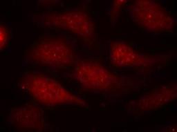 Immunocytochemistry/Immunofluorescence: Cdk6 [p Tyr24] Antibody [NBP1-04958] - Staining of methanol-fixed Hela cells using CDK6 (phospho-Tyr24) antibody