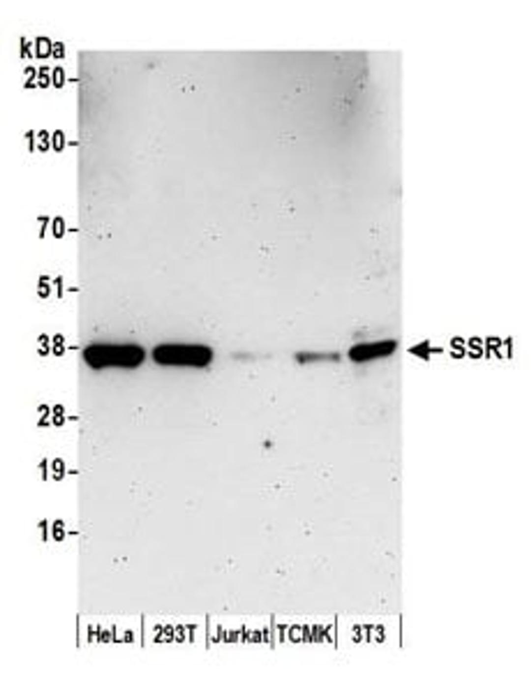 Detection of human and mouse SSR1 by western blot.