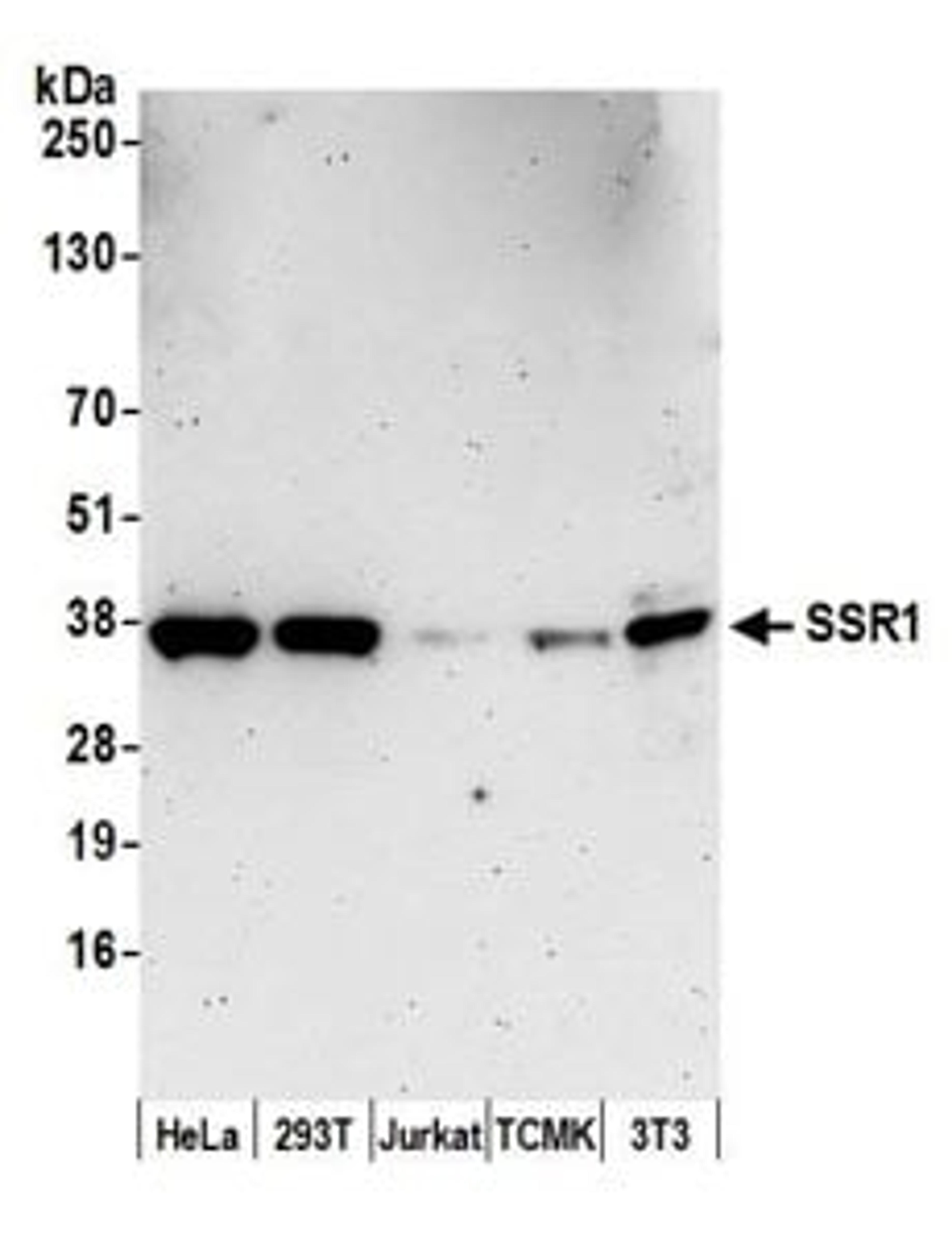 Detection of human and mouse SSR1 by western blot.