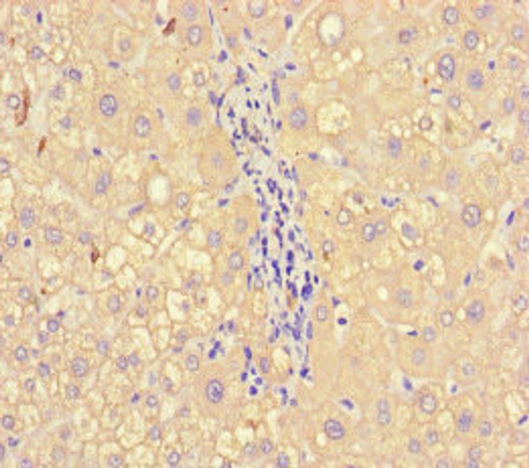 Immunohistochemistry of paraffin-embedded human liver tissue using CSB-PA14579A0Rb at dilution of 1:100