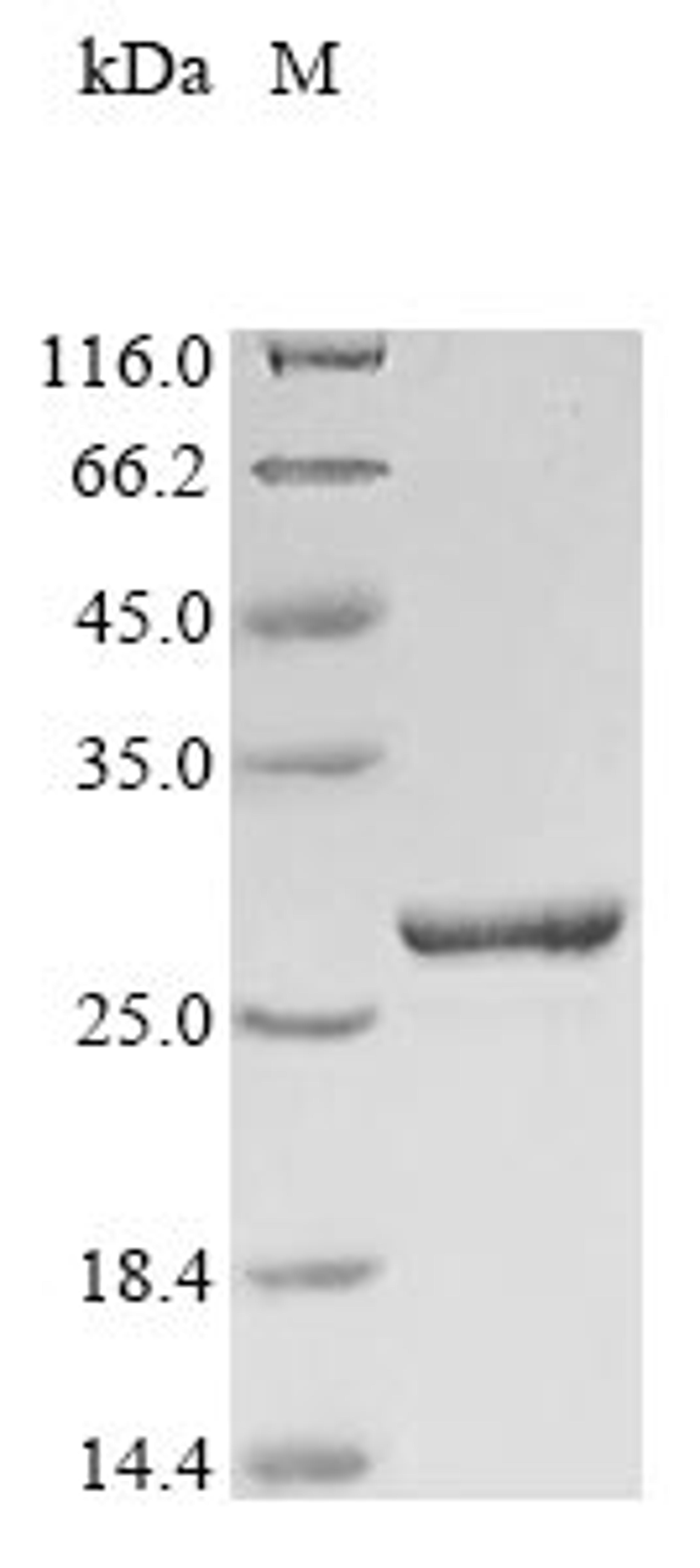 (Tris-Glycine gel) Discontinuous SDS-PAGE (reduced) with 5% enrichment gel and 15% separation gel.