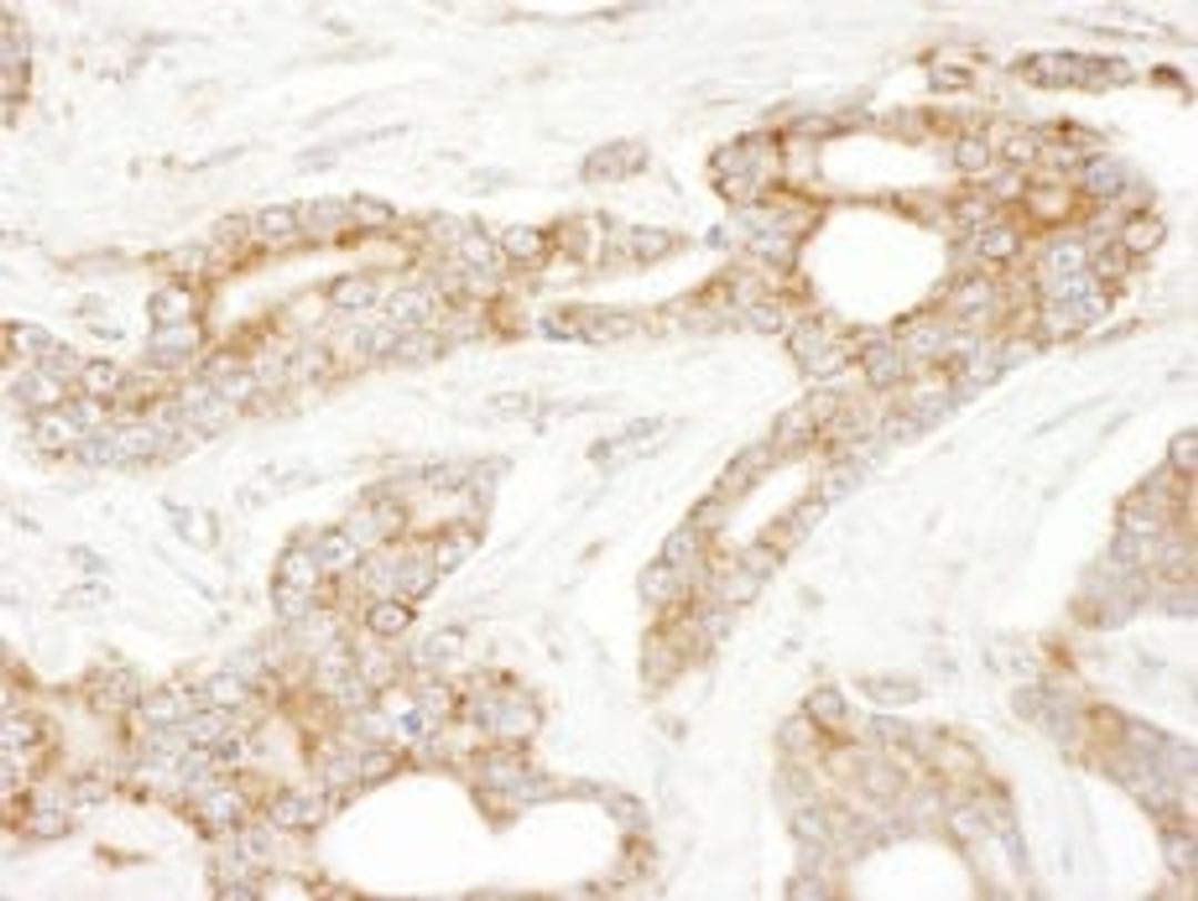 Detection of human CLIP170 by immunohistochemistry.