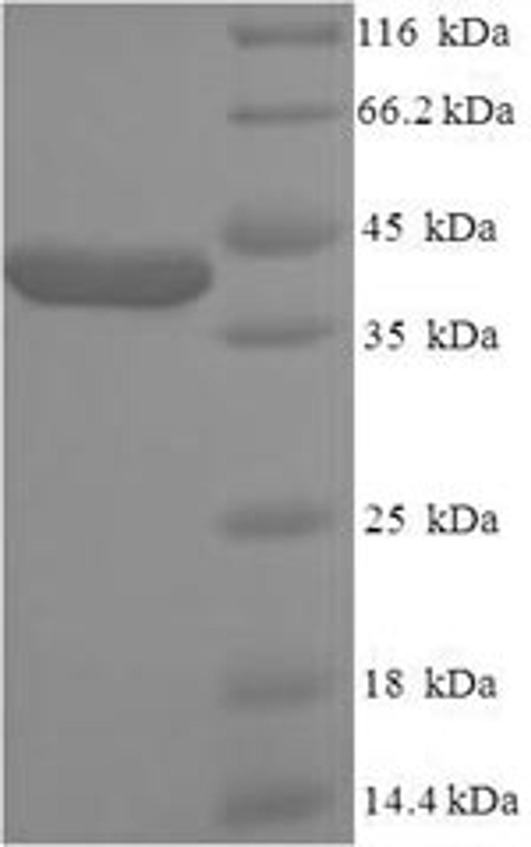 (Tris-Glycine gel) Discontinuous SDS-PAGE (reduced) with 5% enrichment gel and 15% separation gel.