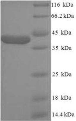 (Tris-Glycine gel) Discontinuous SDS-PAGE (reduced) with 5% enrichment gel and 15% separation gel.
