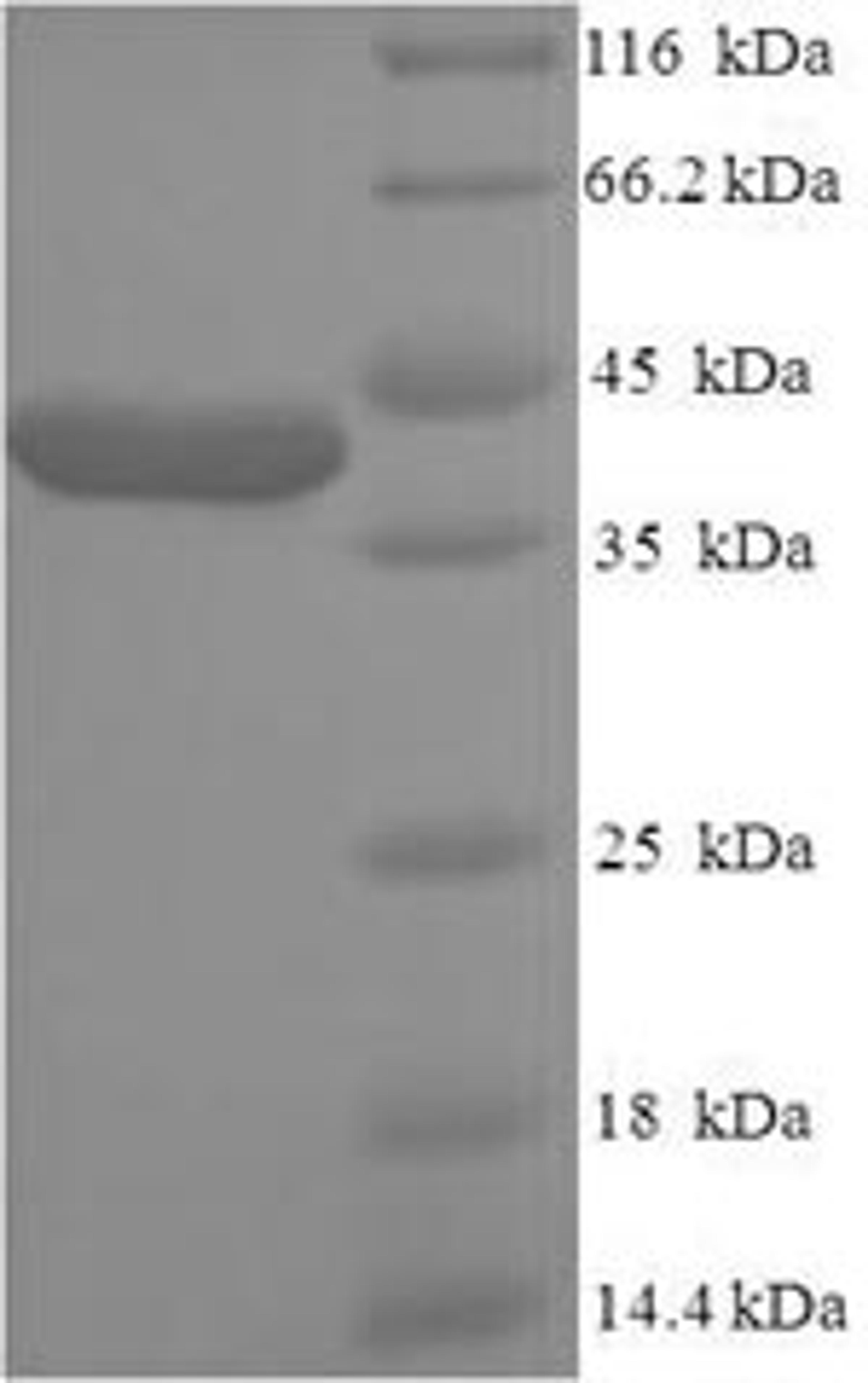 (Tris-Glycine gel) Discontinuous SDS-PAGE (reduced) with 5% enrichment gel and 15% separation gel.