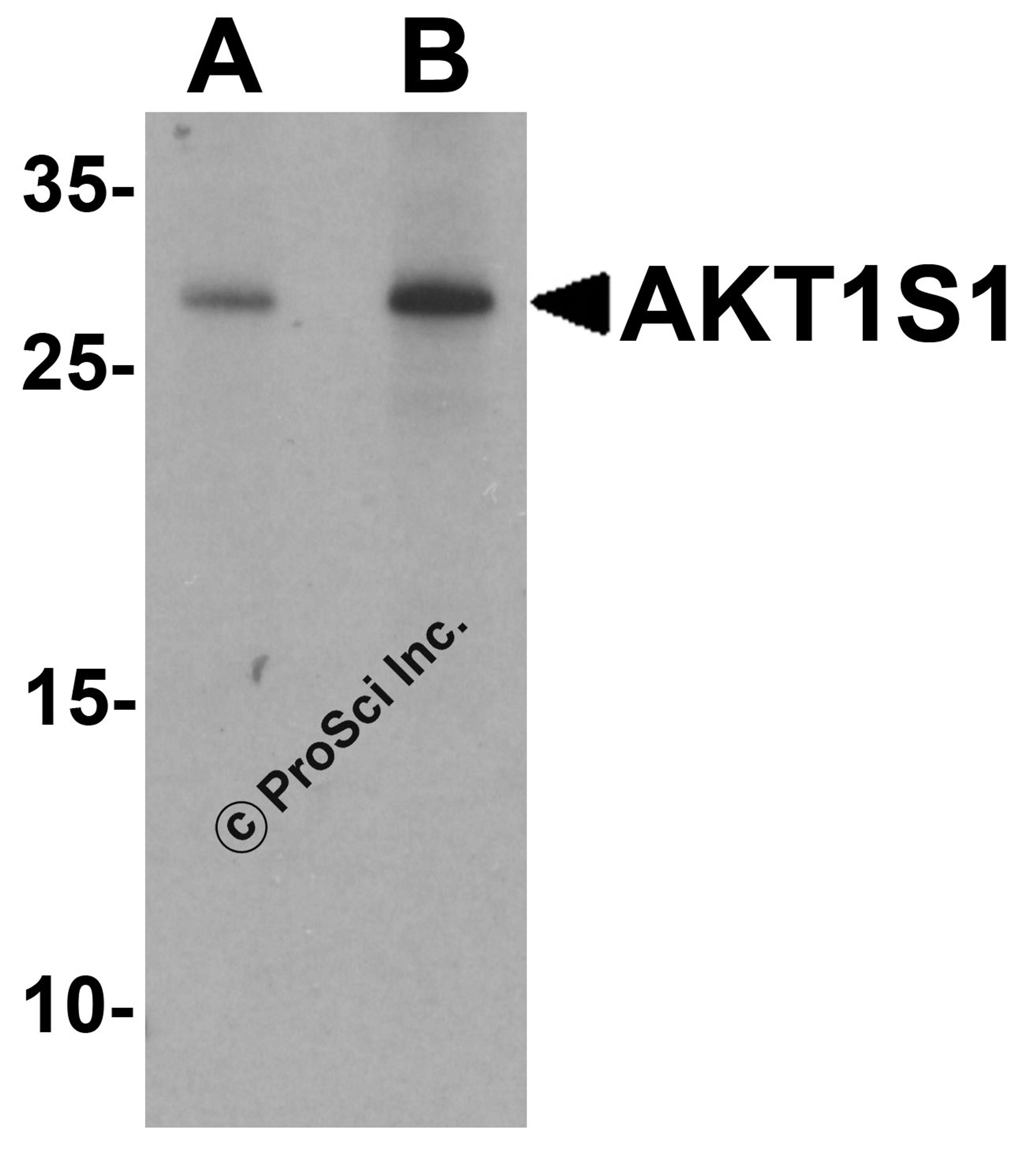 Western blot analysis of AKT1S1 in human brain tissue lysate with AKT1S1 antibody at (A) 1 and (B) 2 μg/mL.
