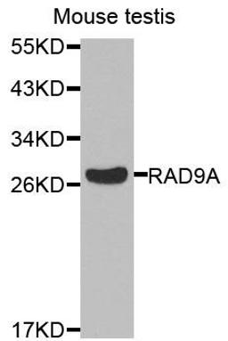 Western blot analysis of extracts of mouse heart cells using RAD9A antibody