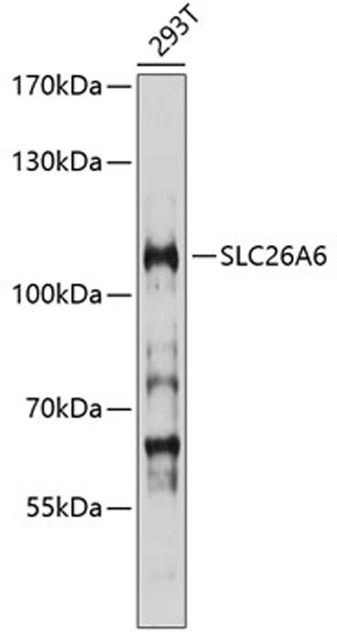 Western blot - SLC26A6 antibody (A10323)