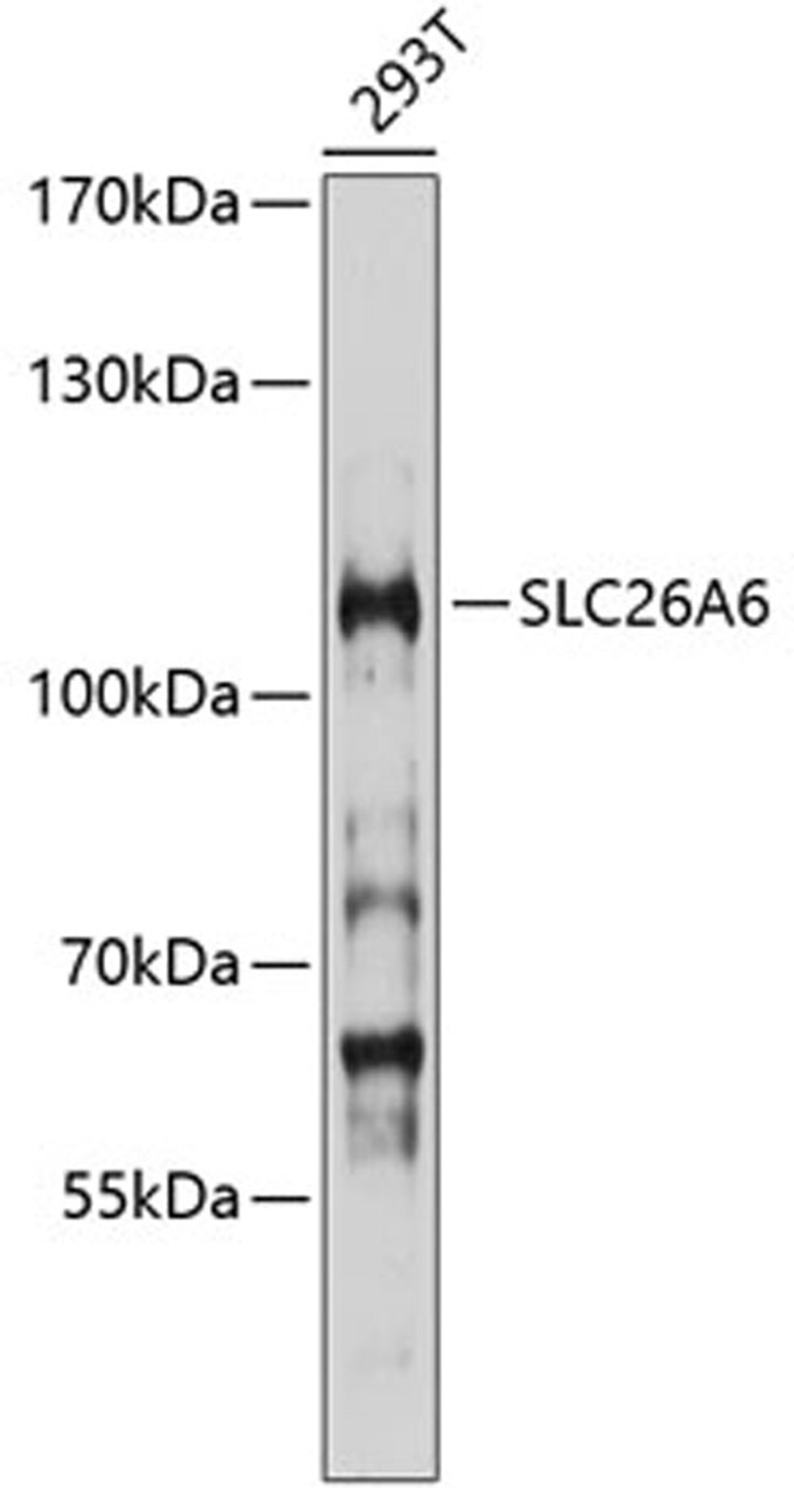 Western blot - SLC26A6 antibody (A10323)