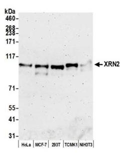 Detection of human and mouse XRN2 by western blot.