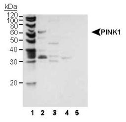 Western Blot: PINK1 Antibody [NB100-493] - Detection of murine PINK1 using NB100-493. 1: molecular weight marker. 2. MES cell Mitochondria (20 ug). 3. MES cytosol (20 ug). 4. MES nuclear (20 ug) as negative control. 5. Purified human cytochrome C (0.1 ug) as PINK1 negative control.