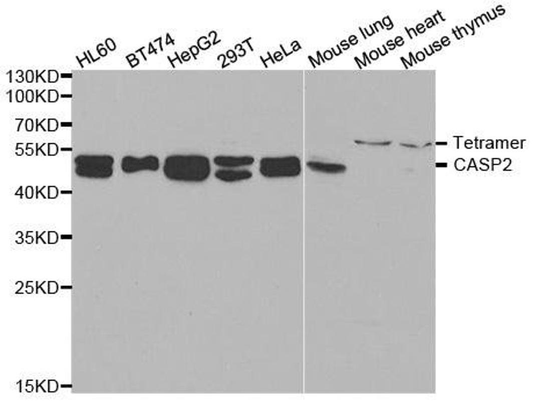 Western blot analysis of extracts of various cell lines using CASP2 antibody