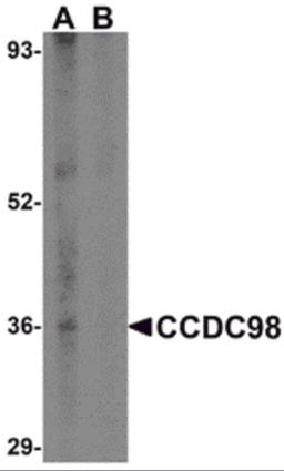 Western blot analysis of CCDC98 in human breast tissue lysate in (A) the absence and (B) presence of blocking peptide with CCDC98 antibody at 1 μg/mL.