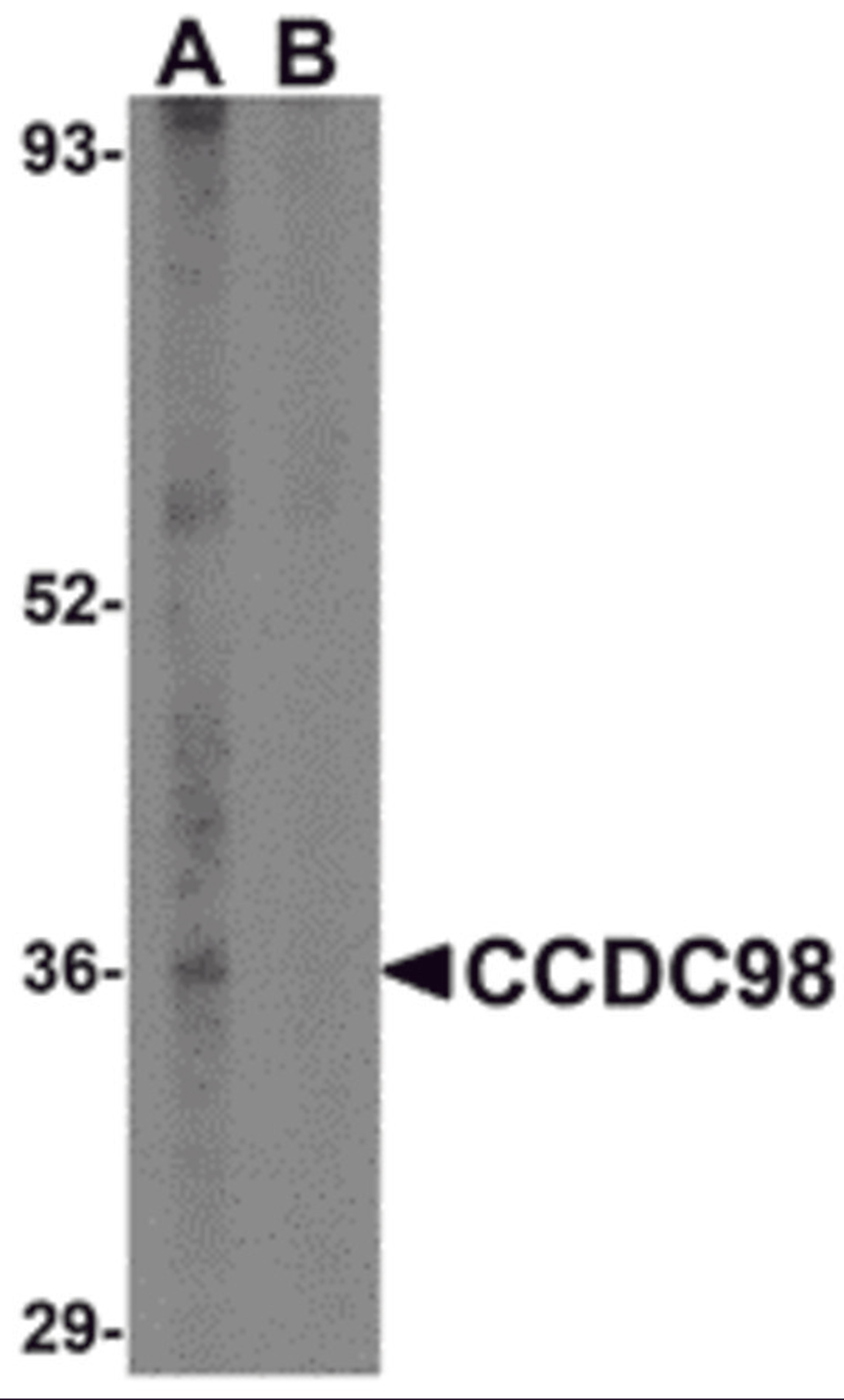 Western blot analysis of CCDC98 in human breast tissue lysate in (A) the absence and (B) presence of blocking peptide with CCDC98 antibody at 1 μg/mL.