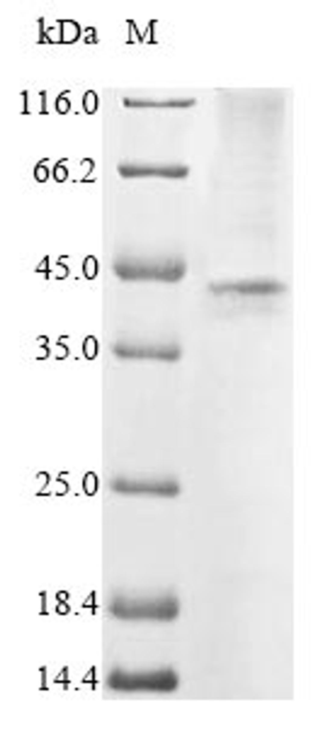 (Tris-Glycine gel) Discontinuous SDS-PAGE (reduced) with 5% enrichment gel and 15% separation gel.