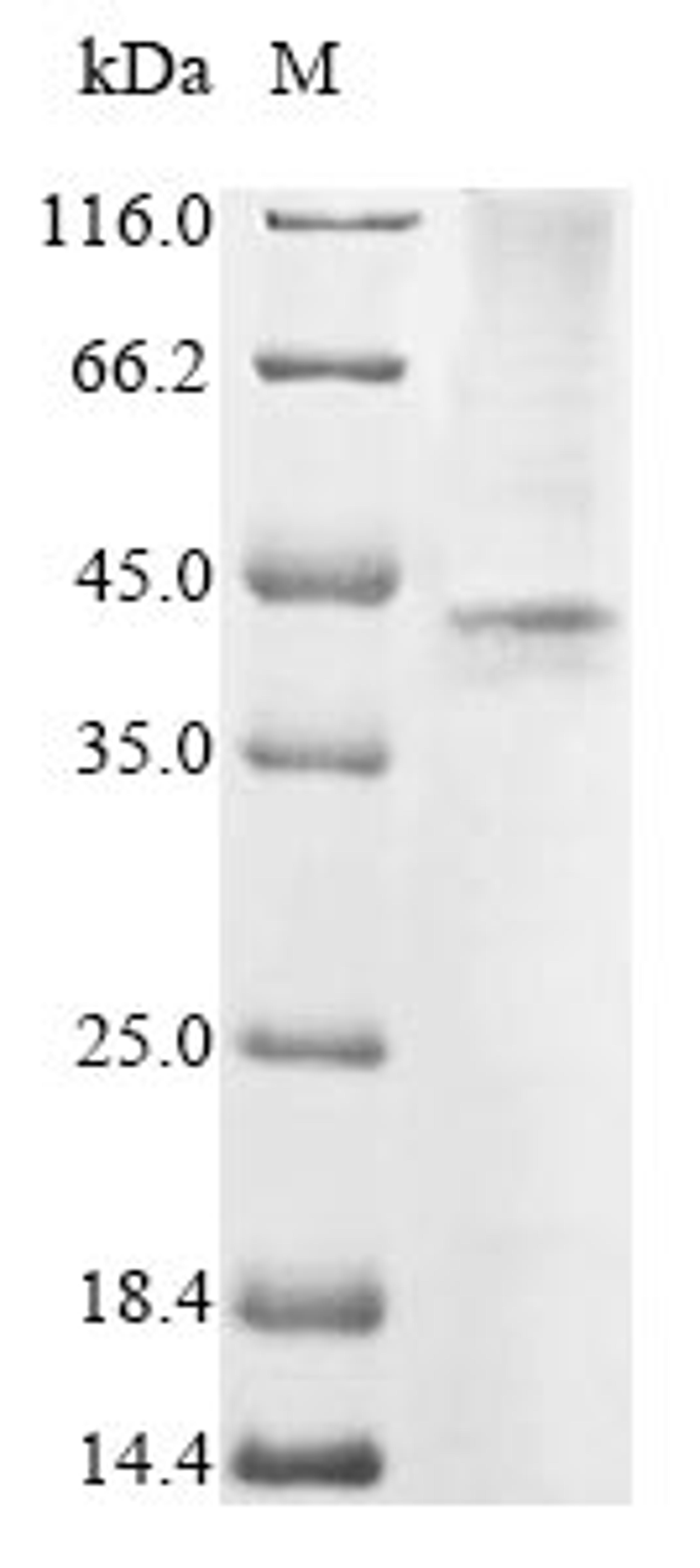 (Tris-Glycine gel) Discontinuous SDS-PAGE (reduced) with 5% enrichment gel and 15% separation gel.