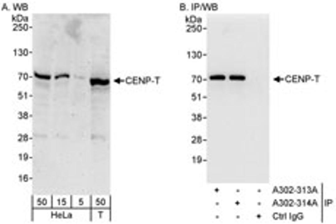 Detection of human CENP-T by western blot and immunoprecipitation.