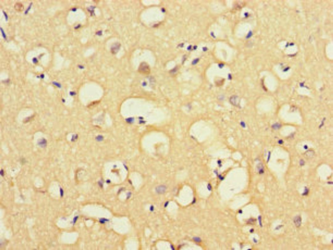 Immunohistochemistry of paraffin-embedded human brain tissue using CSB-PA013433LA01HU at dilution of 1:100