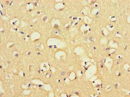 Immunohistochemistry of paraffin-embedded human brain tissue using CSB-PA013433LA01HU at dilution of 1:100