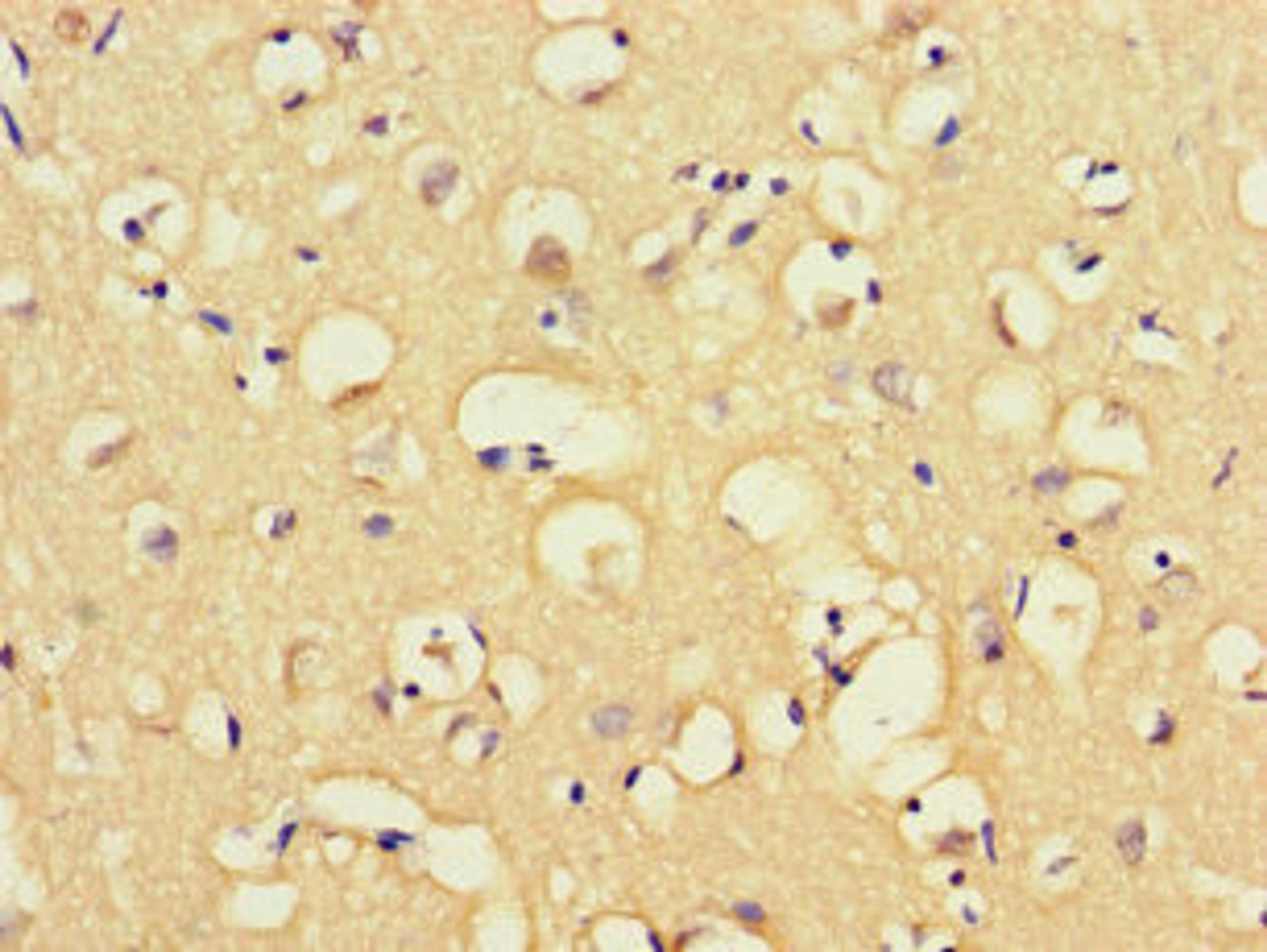 Immunohistochemistry of paraffin-embedded human brain tissue using CSB-PA013433LA01HU at dilution of 1:100