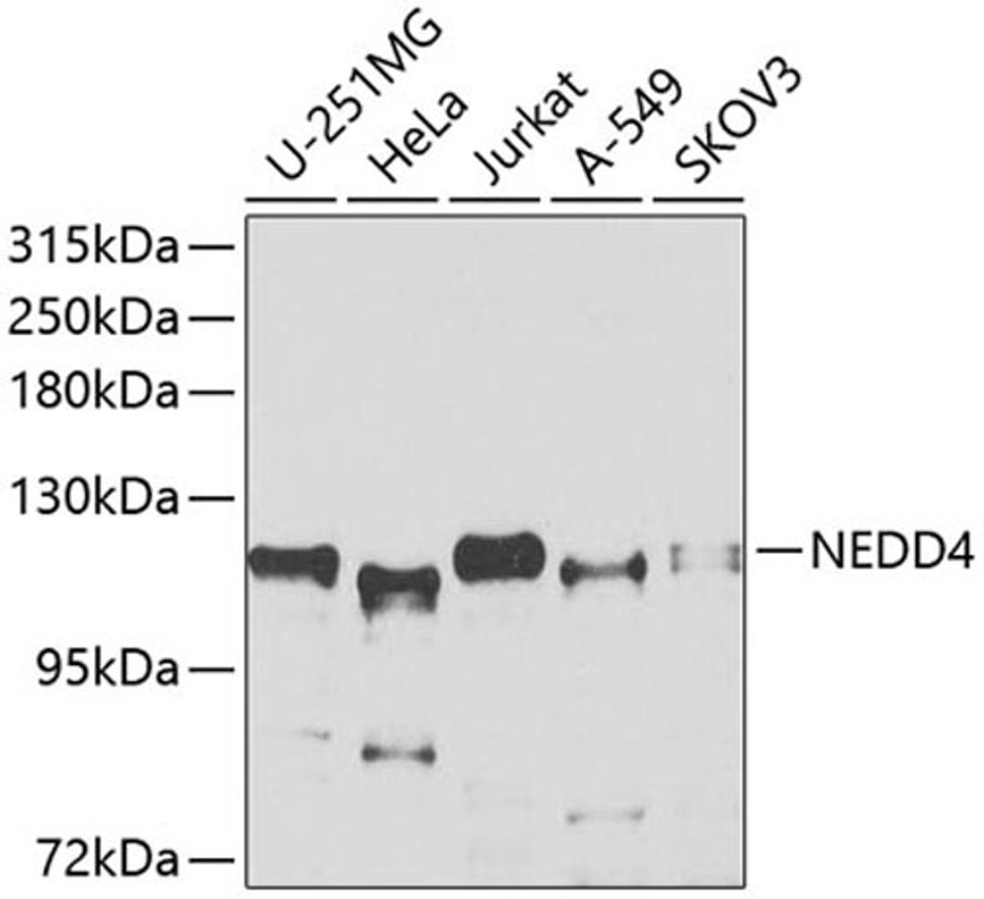 Western blot - NEDD4 antibody (A0552)