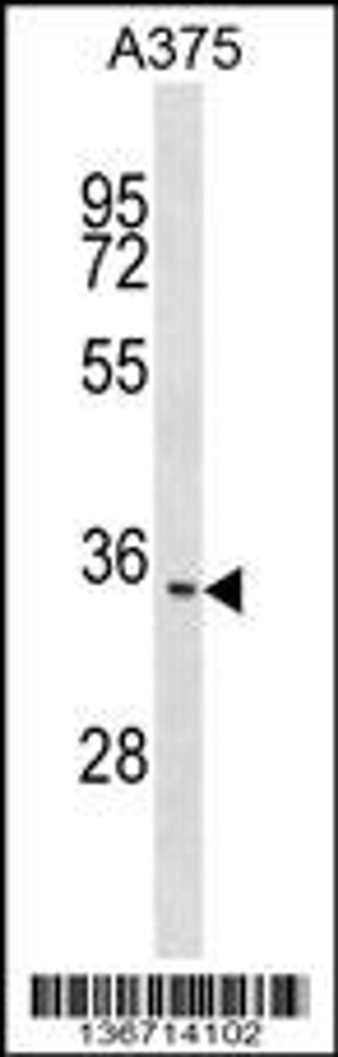 Western blot analysis in A375 cell line lysates (35ug/lane).