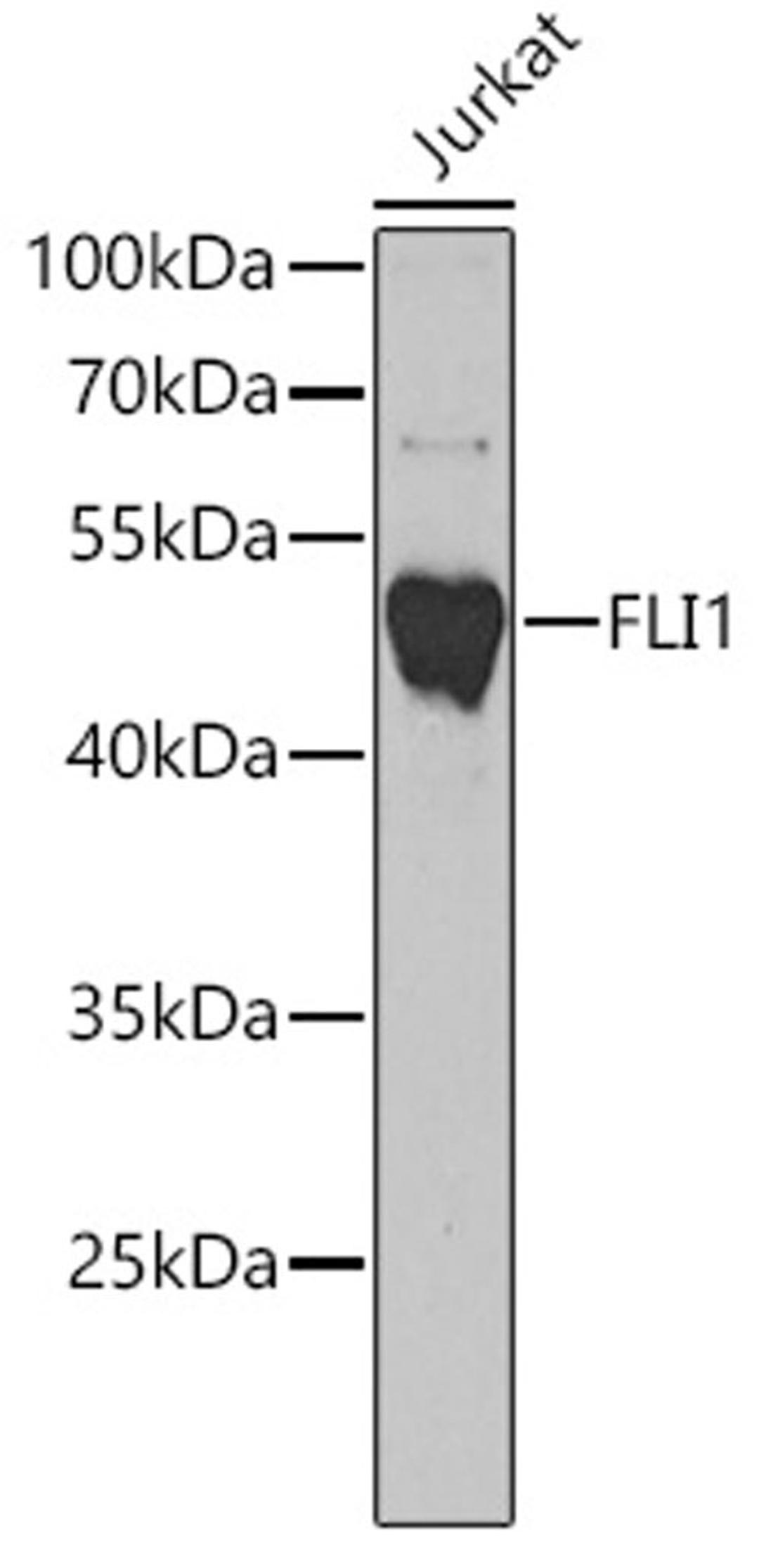 Western blot - FLI1 antibody (A5644)