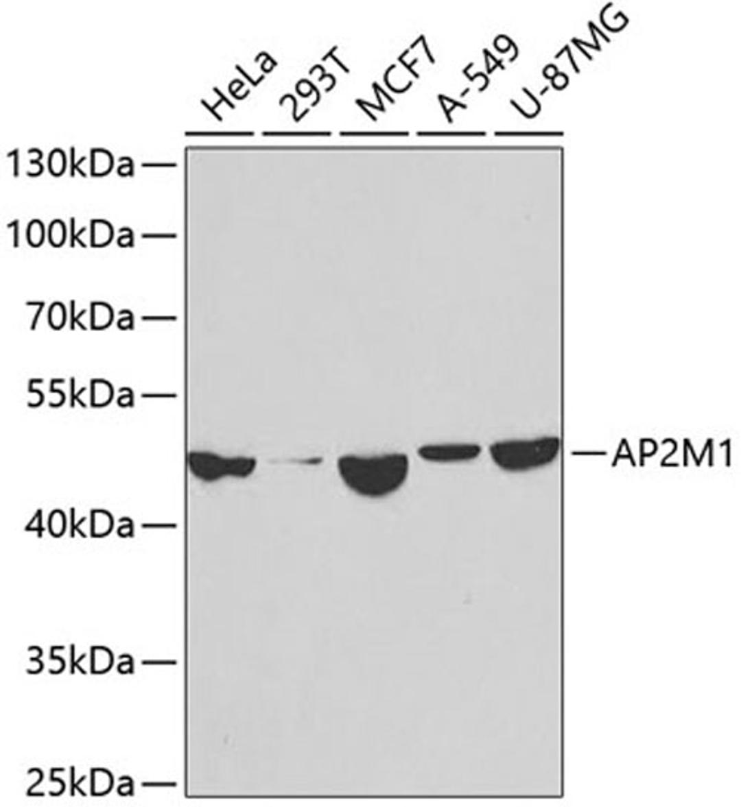 Western blot - AP2M1 antibody (A2492)