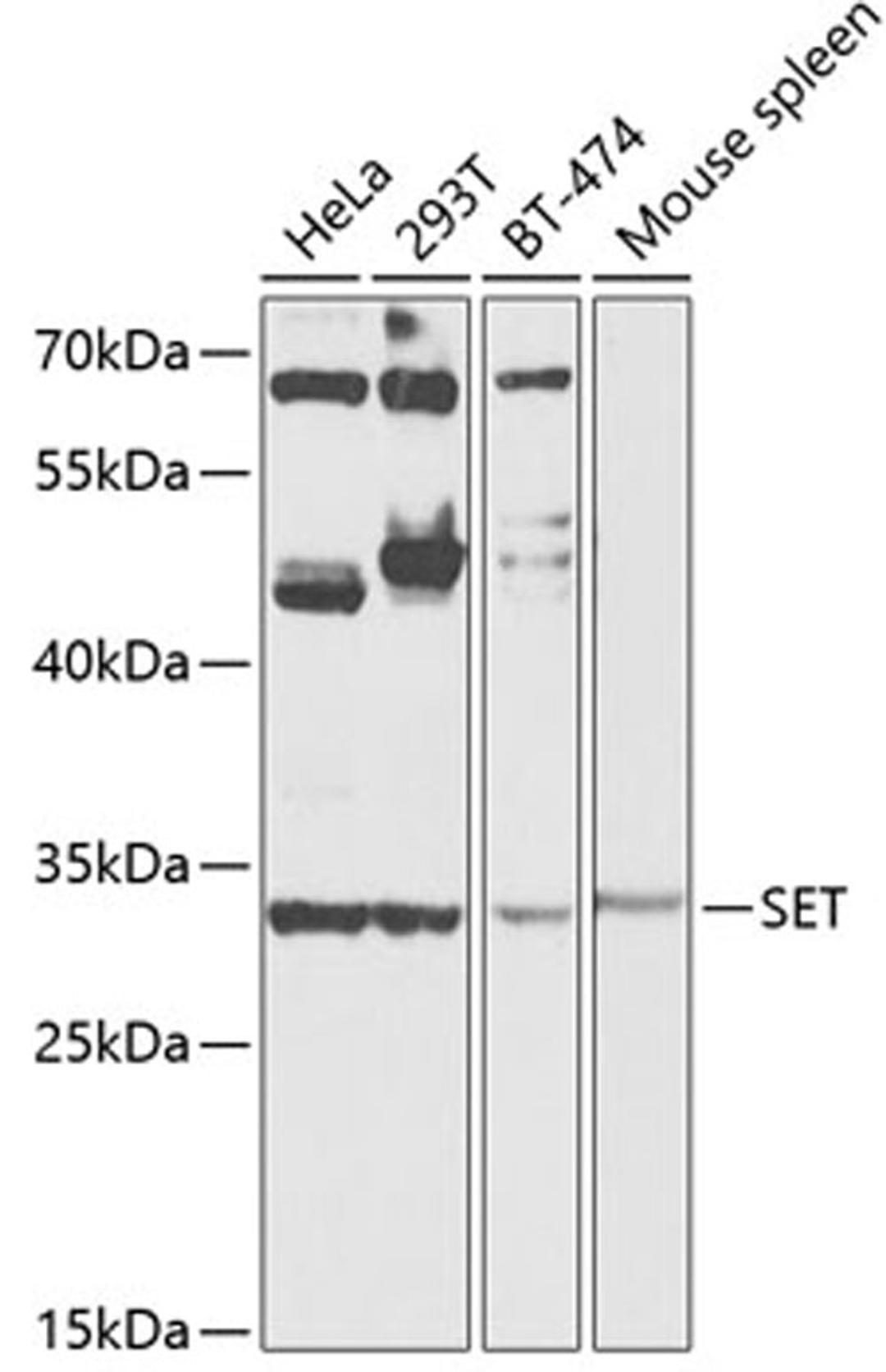 Western blot - SET antibody (A12513)