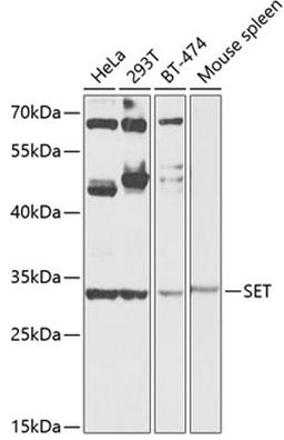 Western blot - SET antibody (A12513)