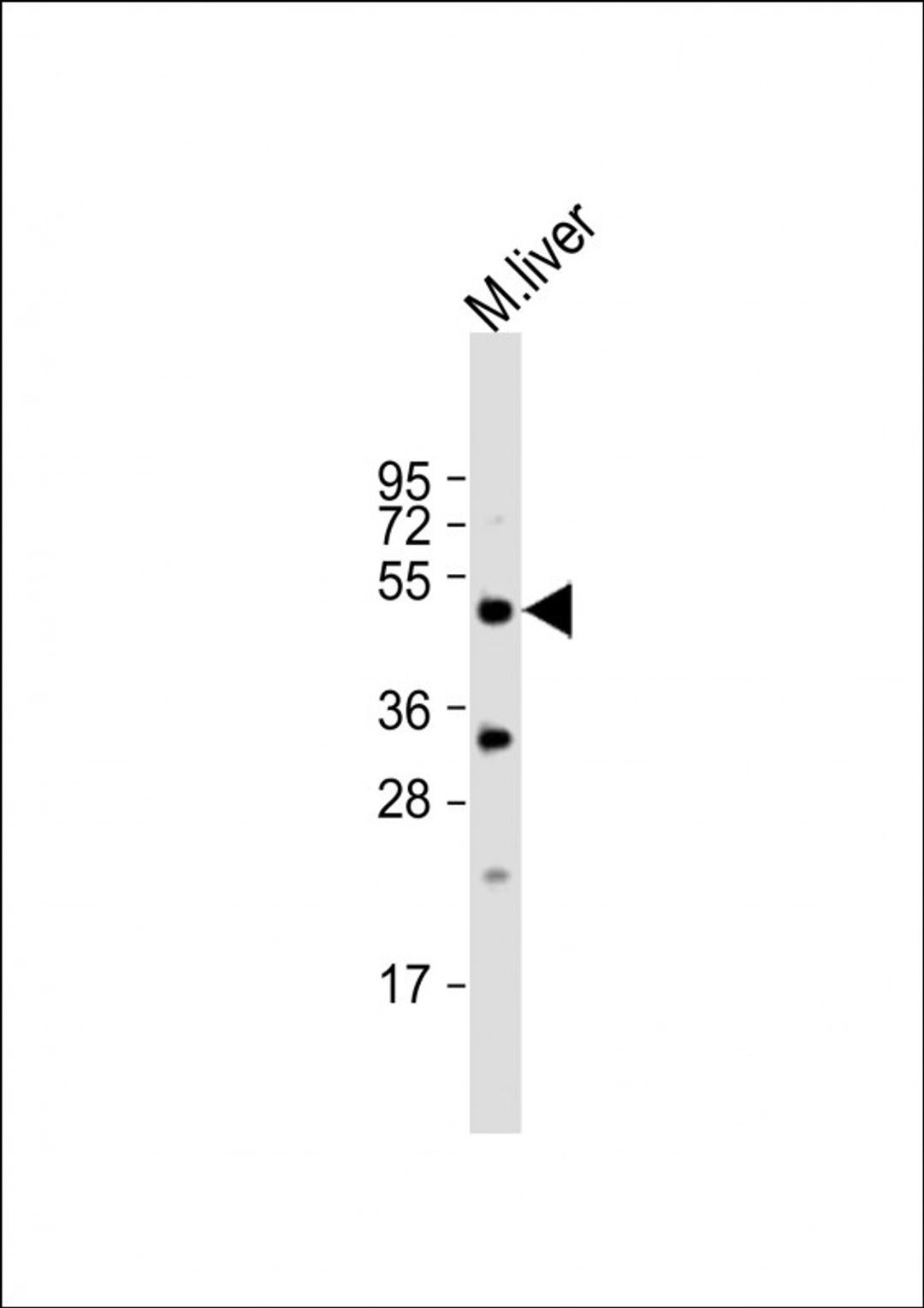 Western Blot at 1:1000 dilution + mouse liver lysate Lysates/proteins at 20 ug per lane.