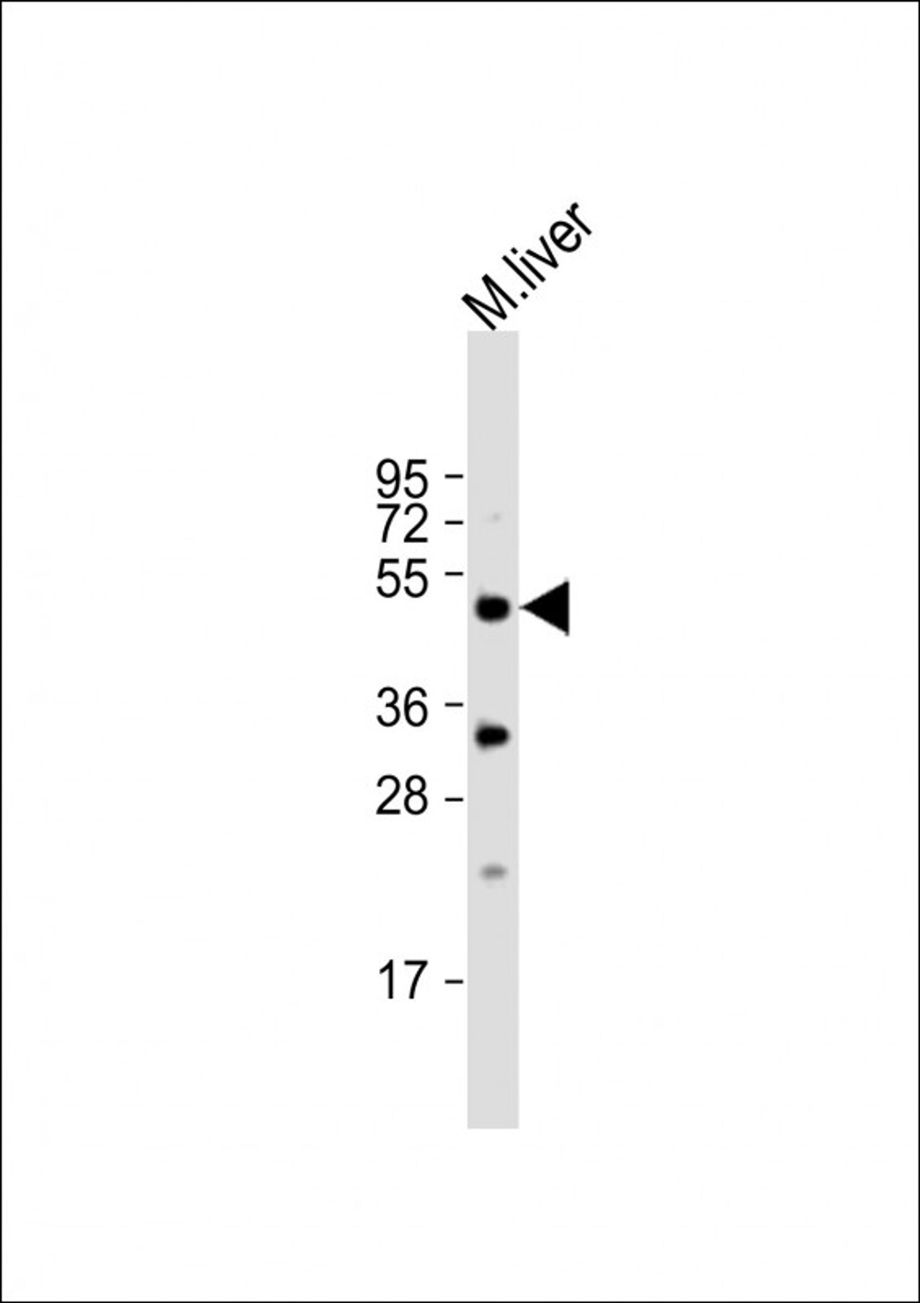 Western Blot at 1:1000 dilution + mouse liver lysate Lysates/proteins at 20 ug per lane.