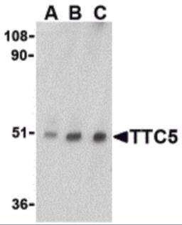 Western blot analysis of TTC5 in RAW264.7 cell lysate with TTC5 antibody at (A) 0.5, (B) 1 and (C) 2 &#956;g/mL. 