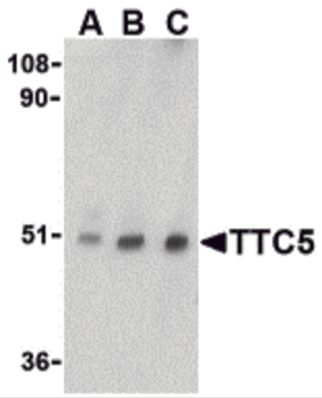 Western blot analysis of TTC5 in RAW264.7 cell lysate with TTC5 antibody at (A) 0.5, (B) 1 and (C) 2 μg/mL.