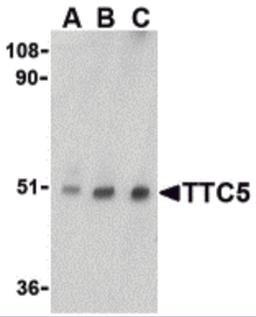 Western blot analysis of TTC5 in RAW264.7 cell lysate with TTC5 antibody at (A) 0.5, (B) 1 and (C) 2 μg/mL.