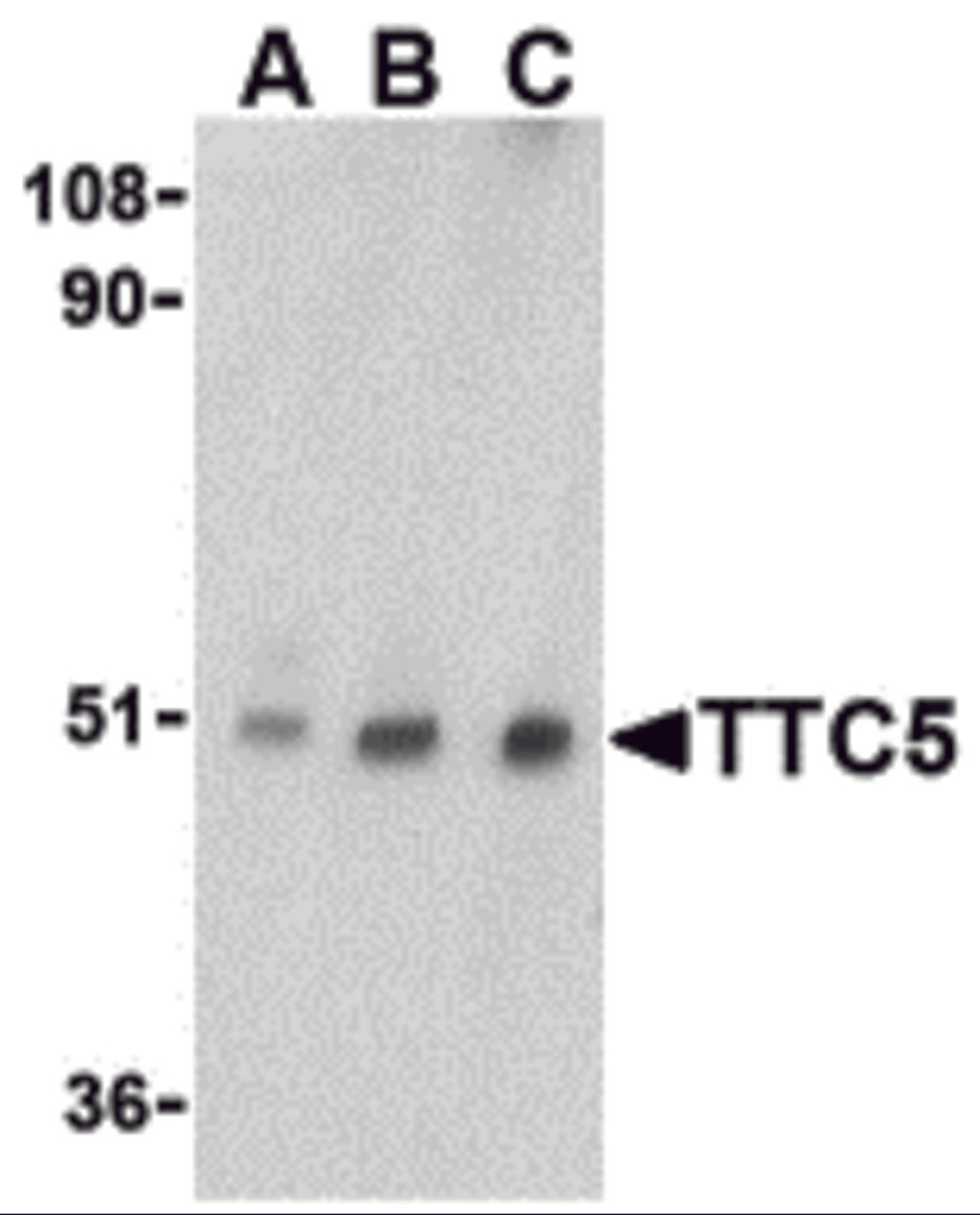 Western blot analysis of TTC5 in RAW264.7 cell lysate with TTC5 antibody at (A) 0.5, (B) 1 and (C) 2 μg/mL.