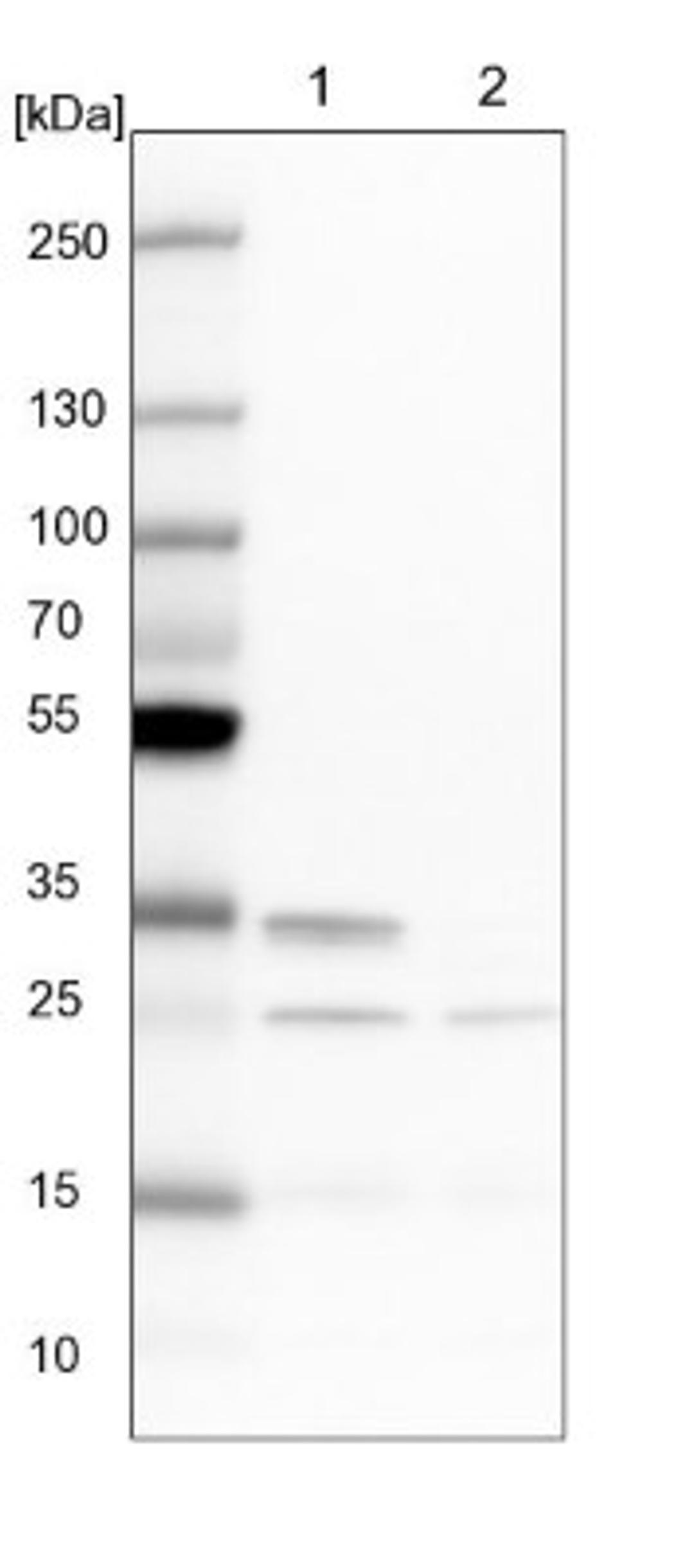 Western Blot: CLE7 homolog Antibody [NBP1-84498] - Lane 1: NIH-3T3 cell lysate (Mouse embryonic fibroblast cells)<br/>Lane 2: NBT-II cell lysate (Rat Wistar bladder tumour cells)