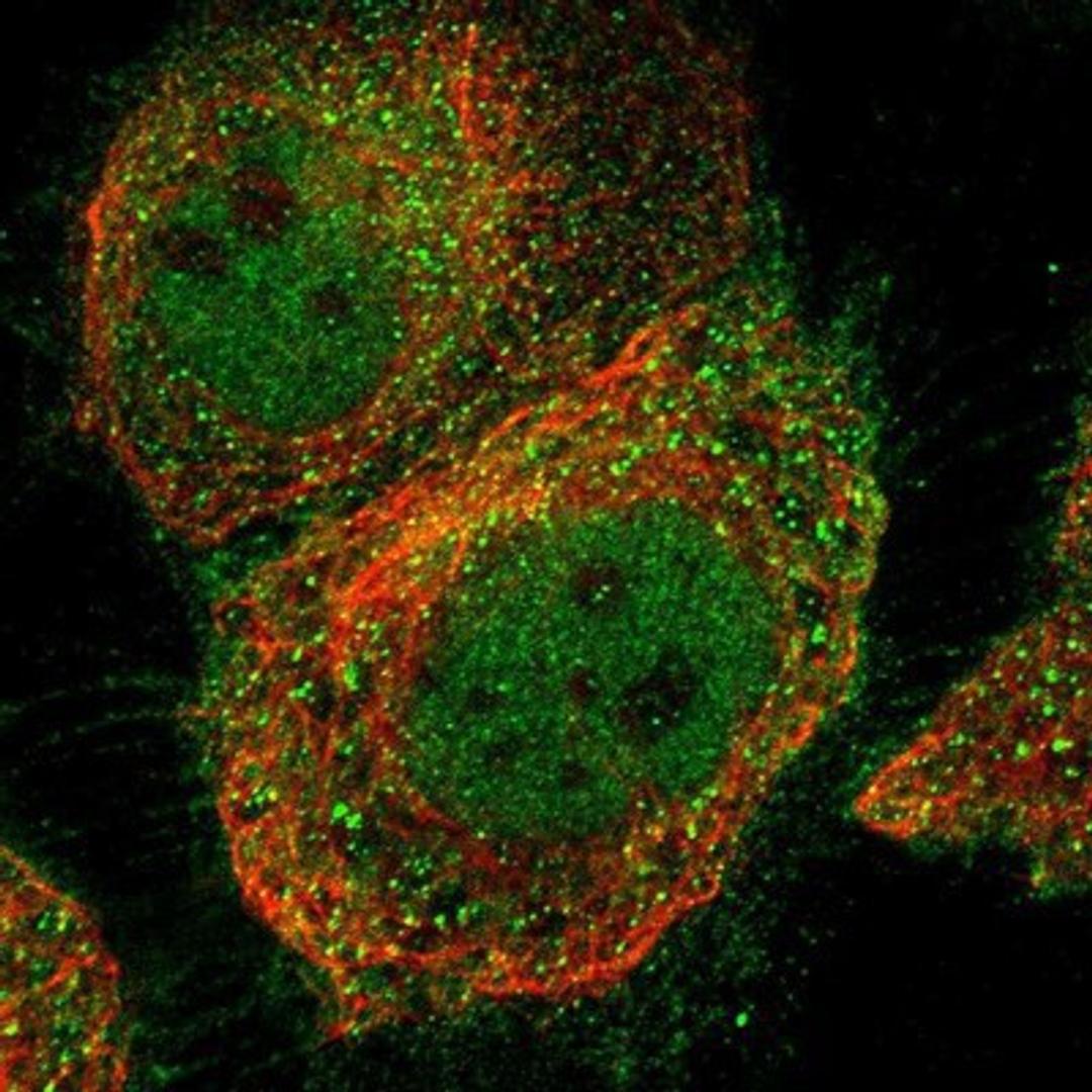 Immunocytochemistry/Immunofluorescence: BBS9 Antibody [NBP1-88927] Staining of human cell line A-431 shows positivity in nucleus but not nucleoli, plasma membrane & cytoplasm.