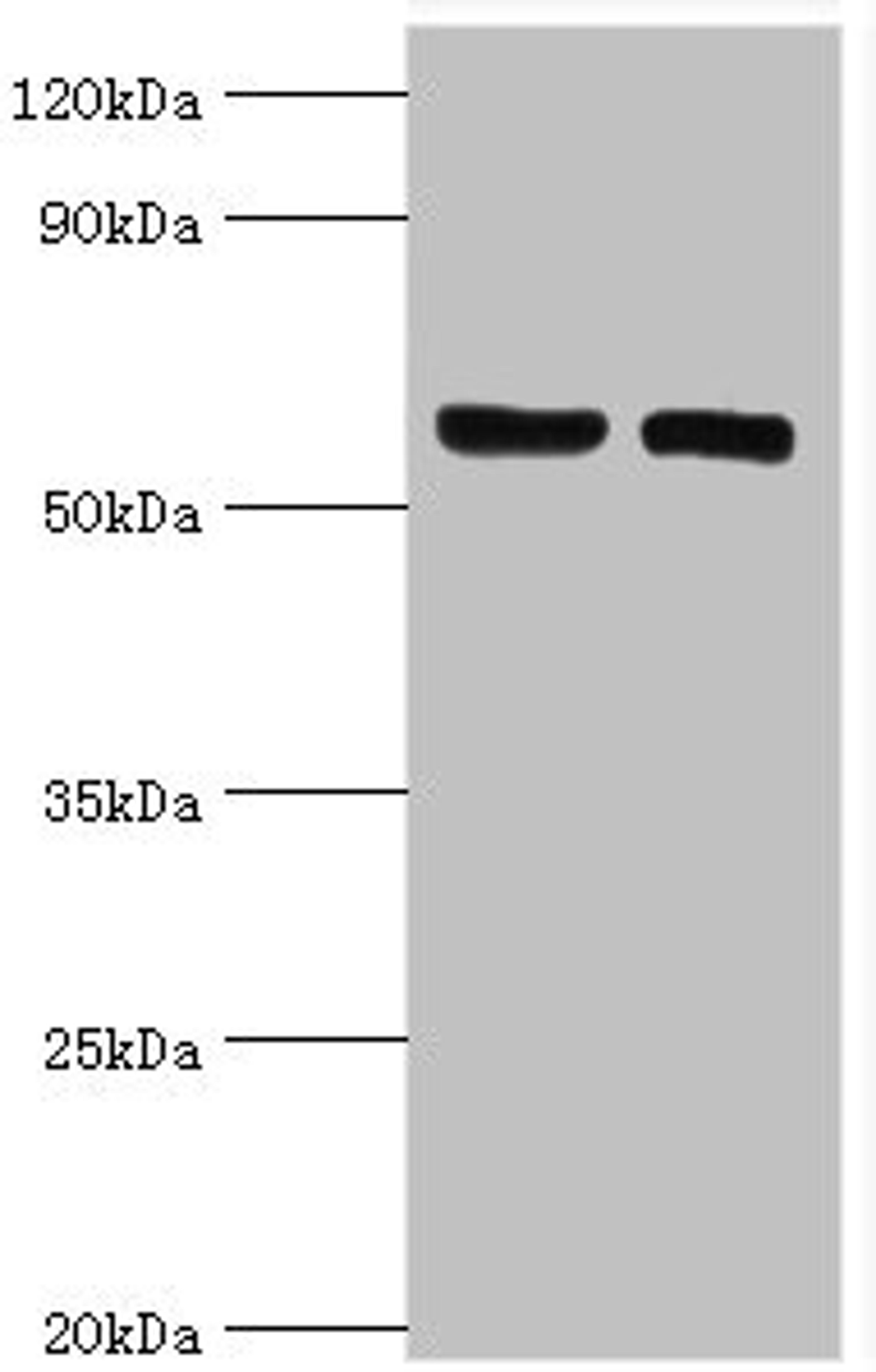 Western blot. All lanes: ADP-ribosylation factor-binding protein GGA2 antibody at 10ug/ml. Lane 1: Rat brain tissue. Lane 2: Mouse liver tissue. Secondary. Goat polyclonal to rabbit IgG at 1/10000 dilution. Predicted band size: 67 kDa. Observed band size: 67 kDa.