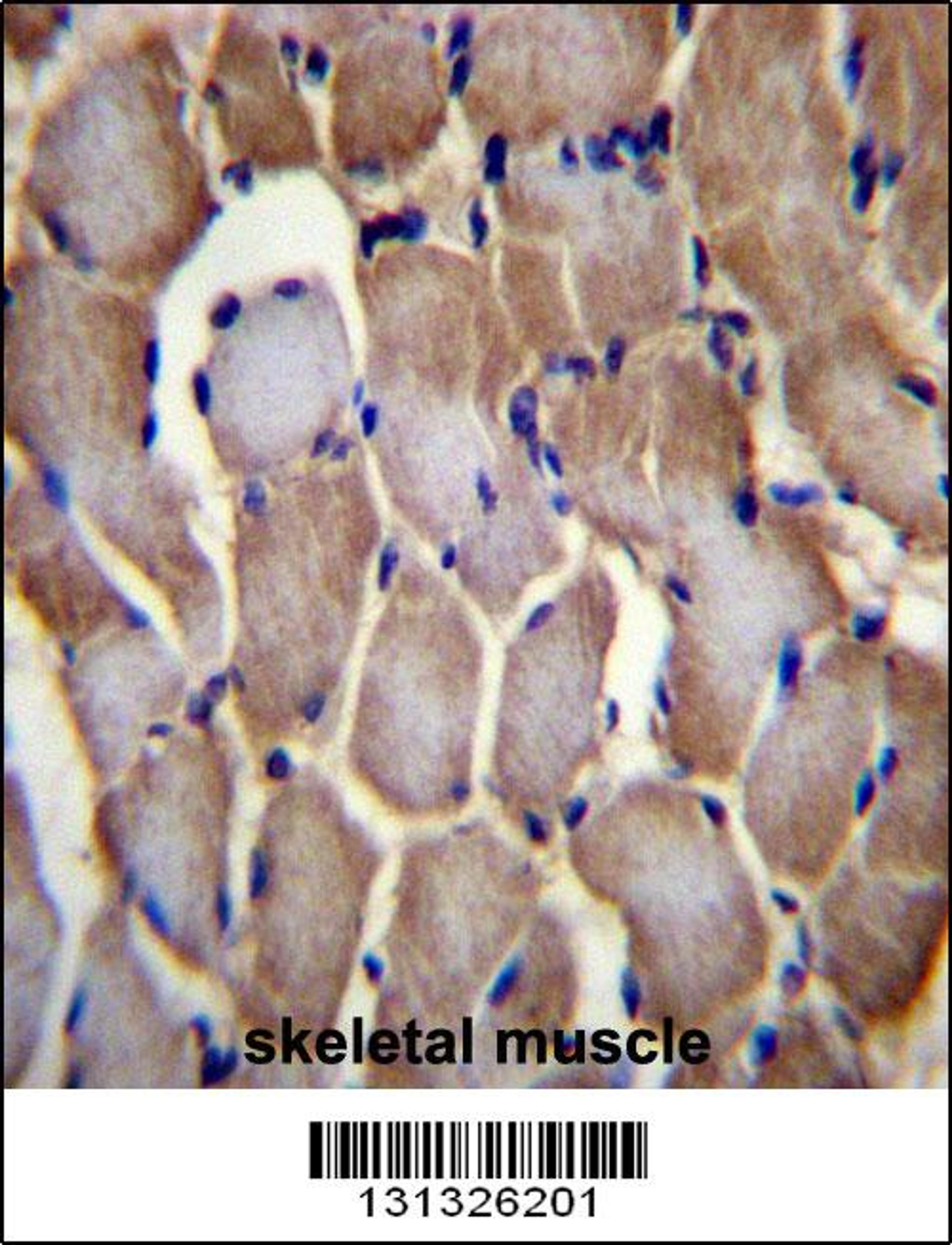 SEPN1 Antibody immunohistochemistry analysis in formalin fixed and paraffin embedded human skeletal muscle followed by peroxidase conjugation of the secondary antibody and DAB staining.