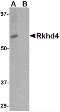 Western blot analysis of Rkhd4 in SK-N-SH cell lysate with Rkhd4 antibody at 1 &#956;g/mL in (A) the absence and (B) the presence of blocking peptide.