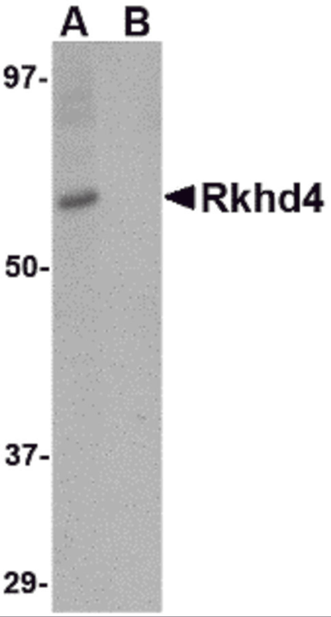 Western blot analysis of Rkhd4 in SK-N-SH cell lysate with Rkhd4 antibody at 1 μg/mL in (A) the absence and (B) the presence of blocking peptide.