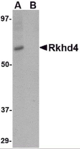 Western blot analysis of Rkhd4 in SK-N-SH cell lysate with Rkhd4 antibody at 1 μg/mL in (A) the absence and (B) the presence of blocking peptide.