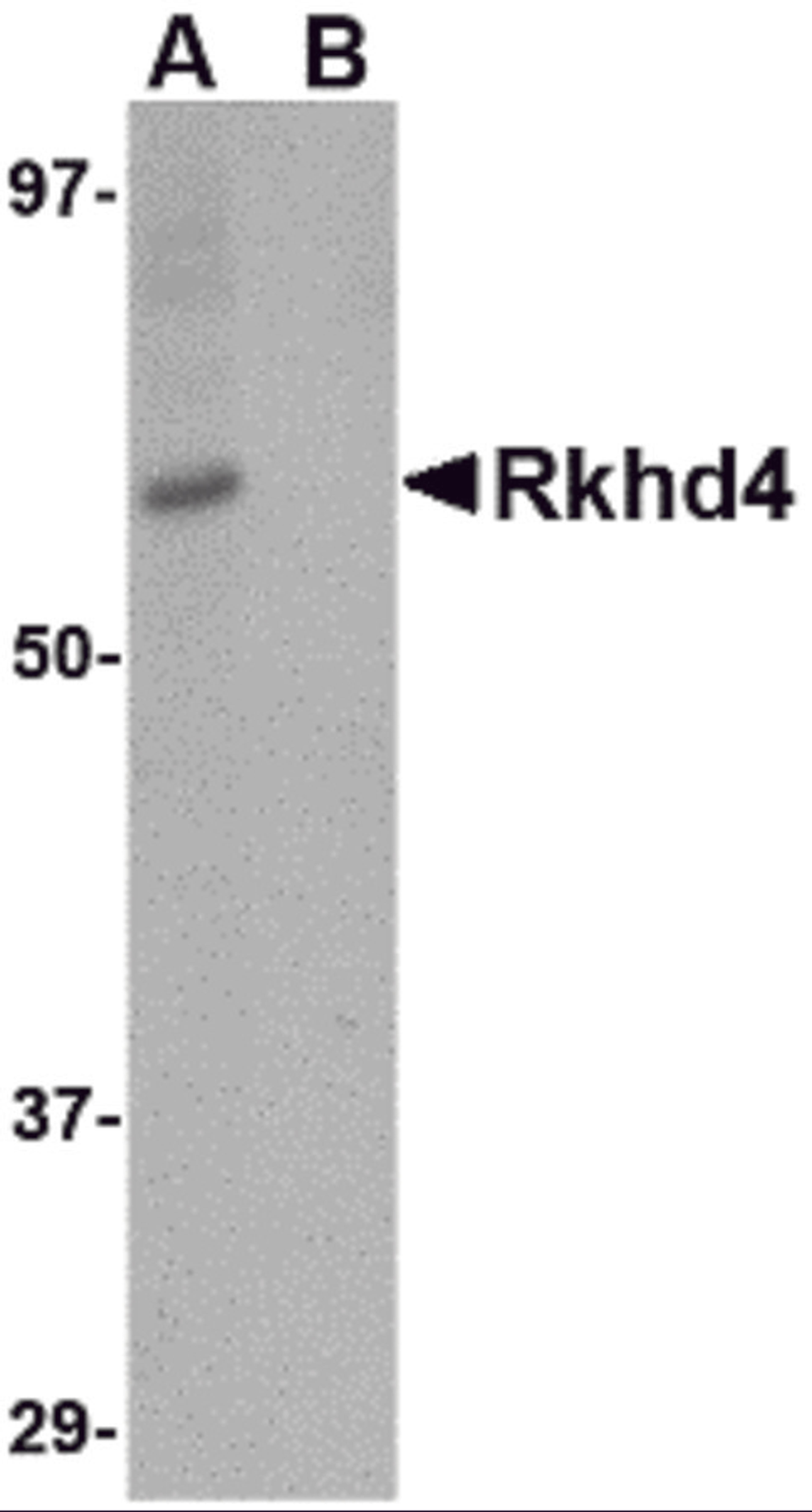 Western blot analysis of Rkhd4 in SK-N-SH cell lysate with Rkhd4 antibody at 1 μg/mL in (A) the absence and (B) the presence of blocking peptide.